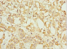 TFCP2 / CP2 Antibody