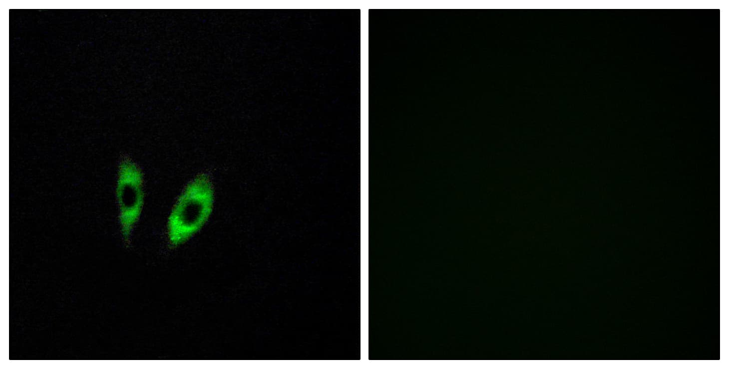 GPR156 Antibody (aa501-550)