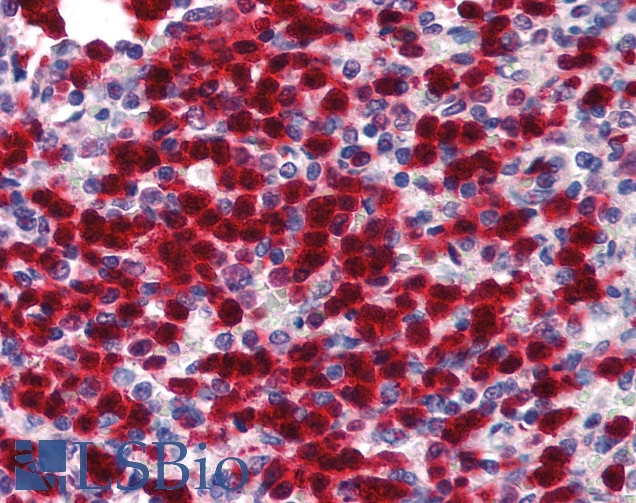 IHC-plus™ CDA / Cytidine Deaminase Antibody (N-Terminus)