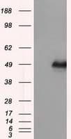 DAPK2 / DAP Kinase 2 Antibody (clone OTI1C5, Carrier-free)