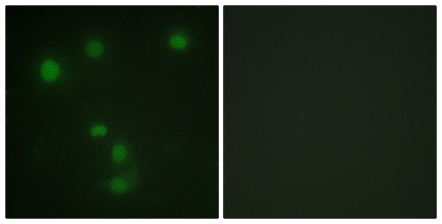 RB1 / Retinoblastoma / RB Antibody (aa601-650)