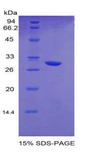 Mouse EGR2 Protein (Recombinant His)