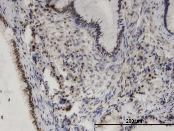 PHKA2 Antibody (clone 3H3)
