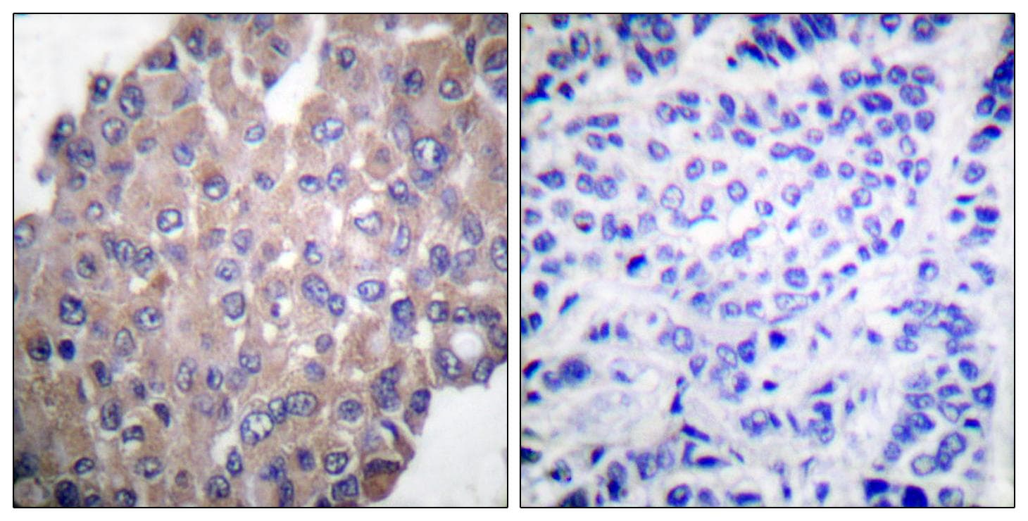 PLCG1 Antibody (phospho-Tyr771)