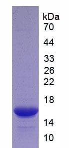 Human TNFRSF9 / 4-1BB / CD137 Protein (Recombinant His, N-Terminal)