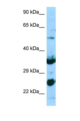 NPL / C112 Antibody (aa61-110)