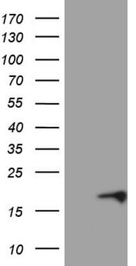 Monoclonal Mouse anti-Human p16INK4a / CDKN2A Antibody (clone OTI8E9, WB)