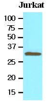 TOLLIP Antibody (aa61-274, clone K1B17)