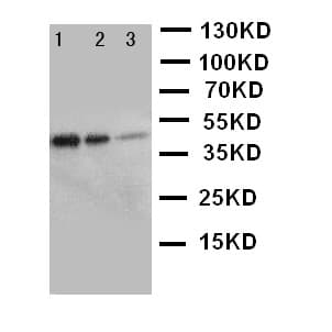 ERBB3 / HER3 Antibody (aa162-181)