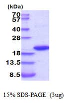 Rat IL1RN Protein (Recombinant His)