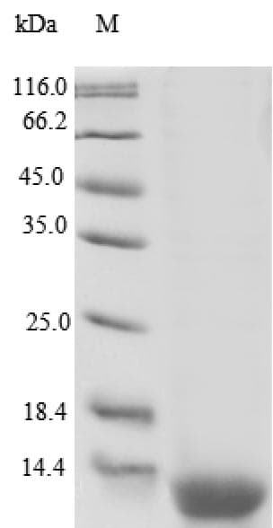 Human RETNLB / RELM-Beta Protein (Recombinant 6His, N-terminus)