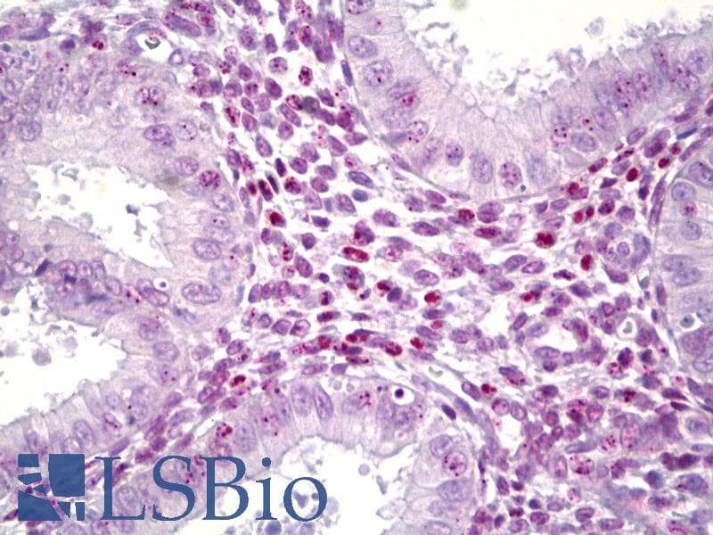 IHC-plus™ Polyclonal Rabbit anti-Human HMG1 / HMGB1 Antibody (aa131-180, IHC, WB)