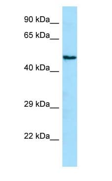 Polyclonal Rabbit anti-Human ANGPTL1 Antibody (aa30-79, WB)
