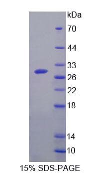 Mouse FOLH1 / PSMA Protein (Recombinant His-T7, N-terminus)