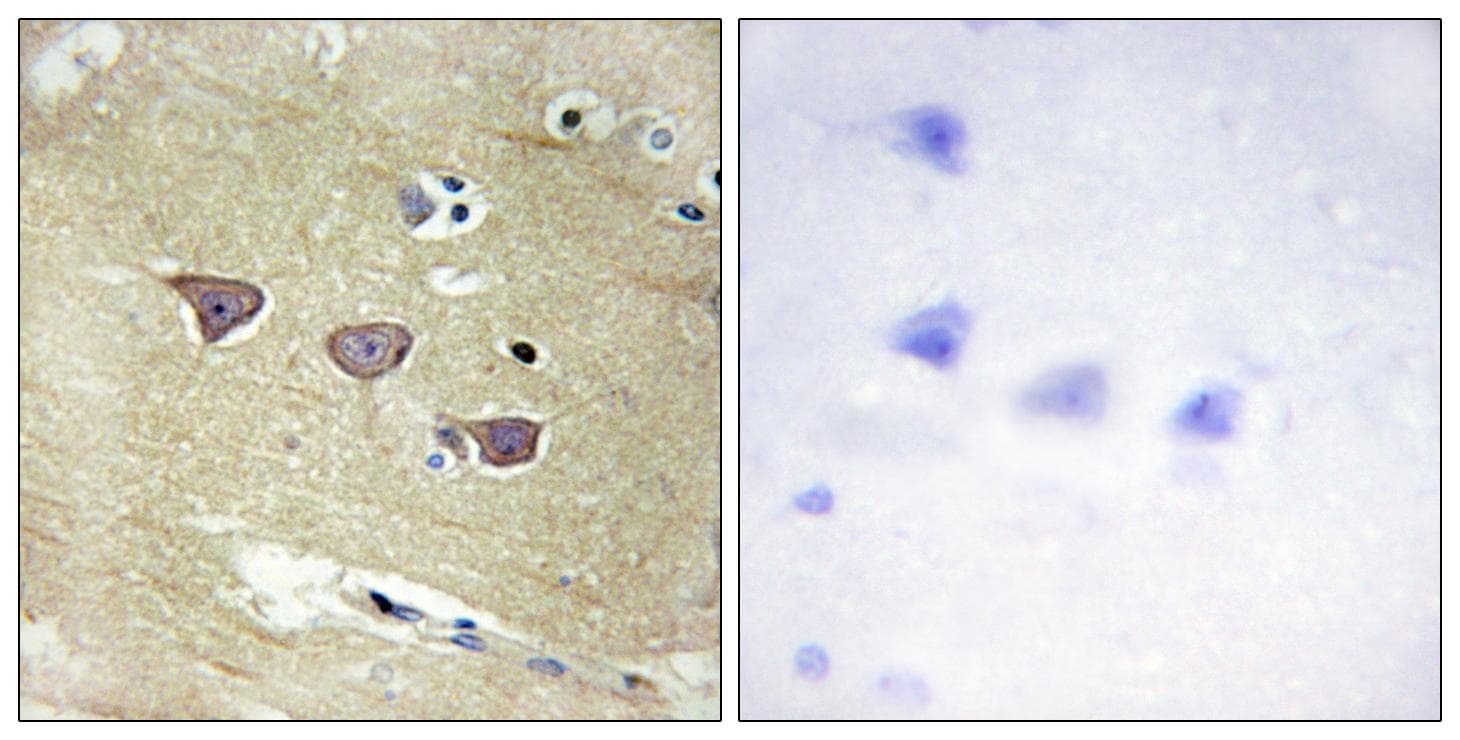 Polyclonal Rabbit anti-Human CAMKV Antibody (IHC, IF, WB)