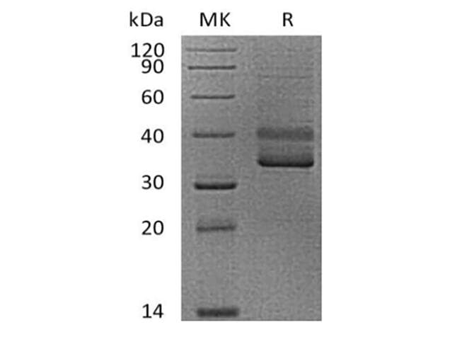 Human CD3E Protein (Recombinant Mouse IgG Fc, C-terminus)
