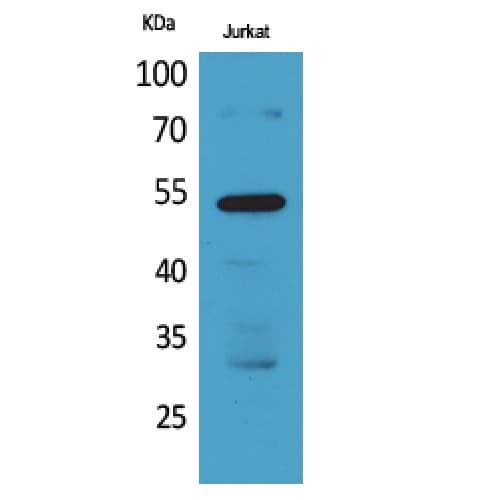 Polyclonal Rabbit anti-Human BMP3 Antibody (411-460 aa, C-terminal, IHC, WB)