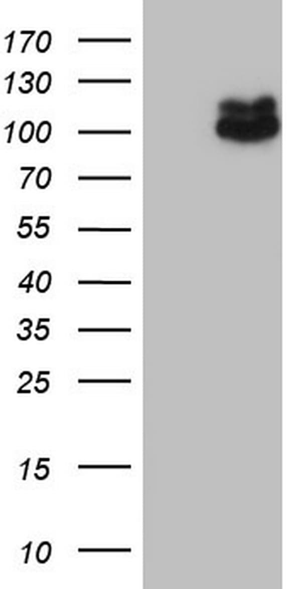 Monoclonal Mouse anti-Human MDM2 Antibody (clone OTI24C7, aa119-438, WB)