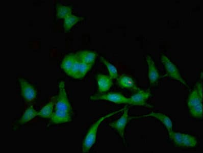 Polyclonal Rabbit anti-Human MAN2C1 Antibody
