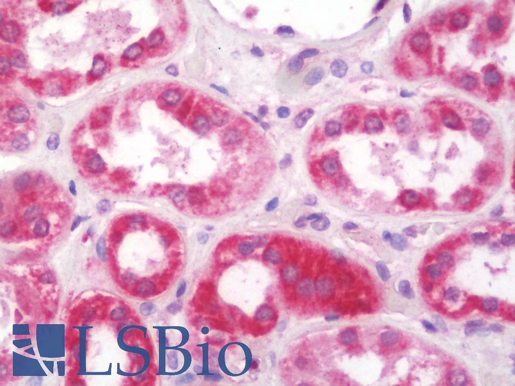 IHC-plus™ NDUFS5 Antibody