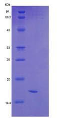 Human SEMA4D / Semaphorin 4D / CD100 Protein (Recombinant His)