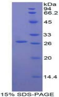 Human TIGIT Protein (Recombinant His-T7)
