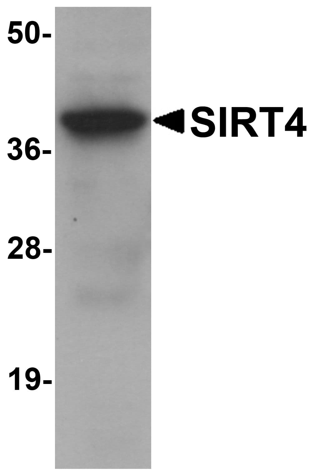 Polyclonal Chicken anti-Human SIRT4 / Sirtuin 4 Antibody (WB)