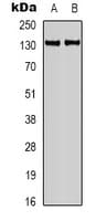CASR/Calcium Sensing Receptor Antibody