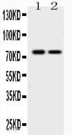 KCNQ1 / KVLQT1 Antibody