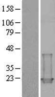 Human TNNC1 / Cardiac Troponin C Protein (Over-Expression Lysate Myc-DDK (Flag))