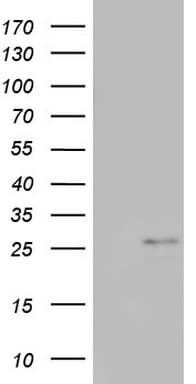 Monoclonal Mouse anti-Human CHCHD3 Antibody (clone OTI2G8, aa2-227, WB)