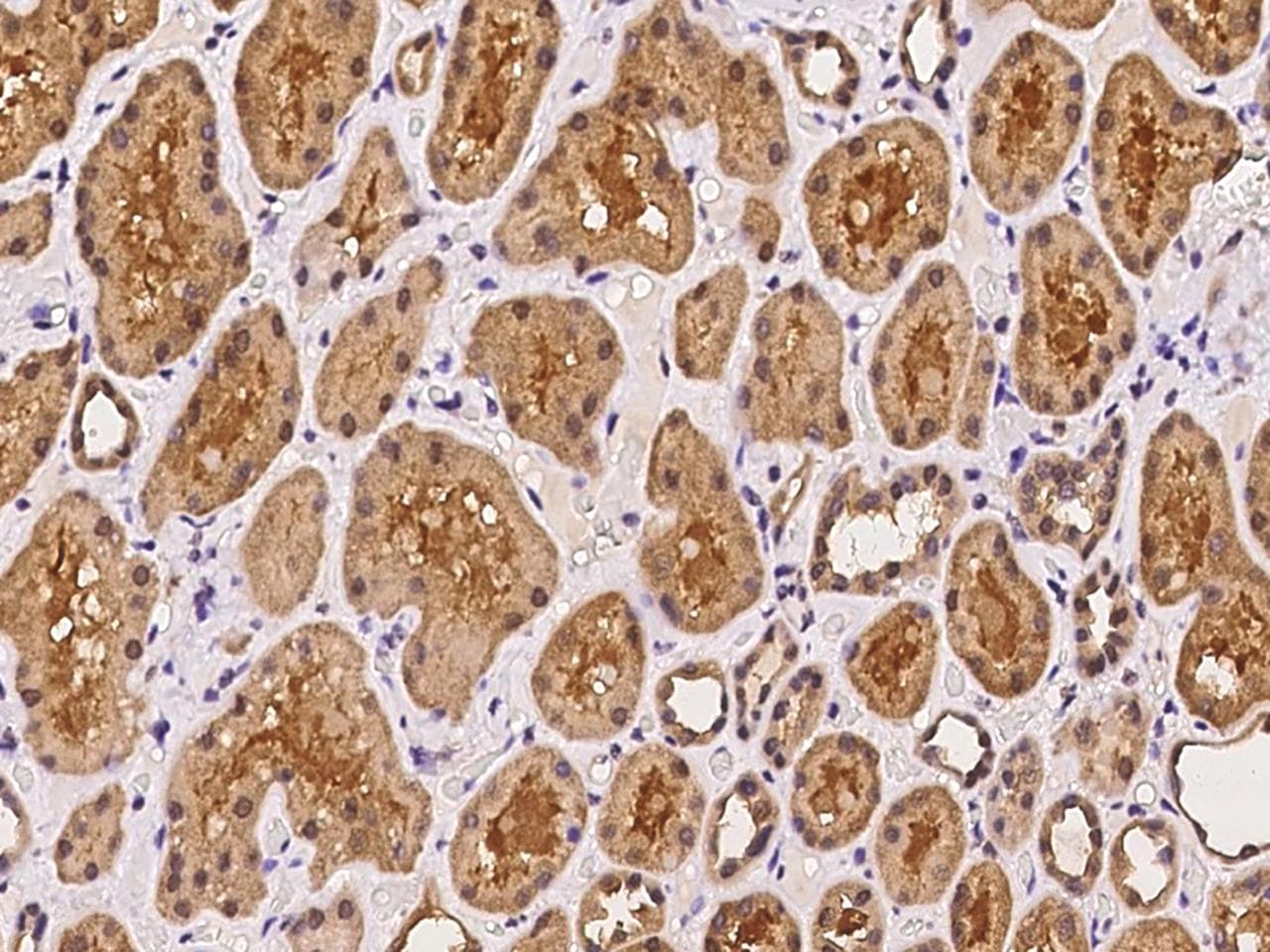 ARFL3 / ARL3 Antibody