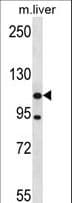 ADNP2 Antibody (aa702-731)