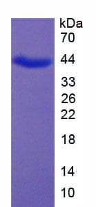 Rabbit MBP / Myelin Basic Protein (Recombinant His-GST, N-terminus)