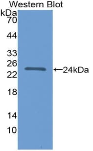 FGF21 Antibody (aa25-208)