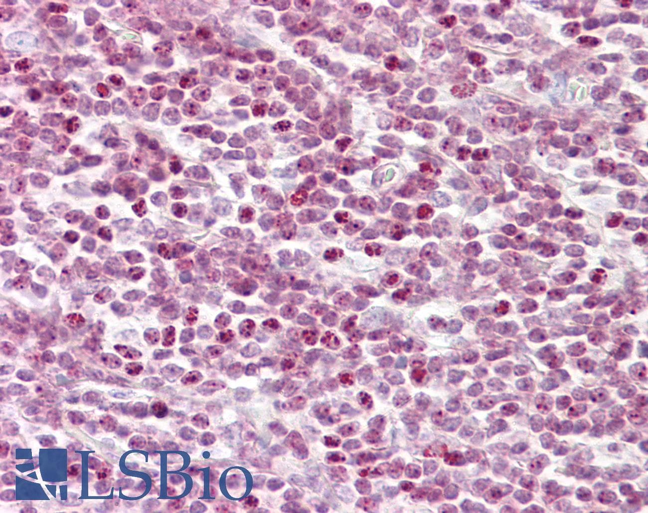 IHC-plus™ Polyclonal Rabbit anti-Human Histone H2B Antibody (aa1-50, IHC, IF, WB)