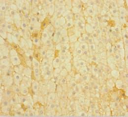 Polyclonal Rabbit anti-Human POMC / Proopiomelanocortin Antibody (WB)