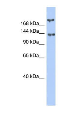 BRCA1 Antibody (aa1151-1200)