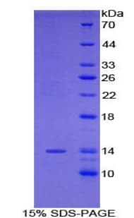 Mouse RSPO1 / RSPO Protein (Recombinant His)