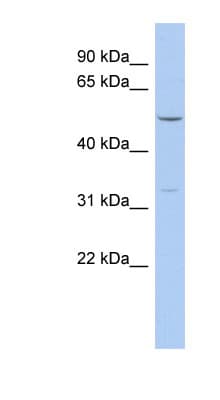 FBXO15 / FBX15 Antibody (aa71-120)
