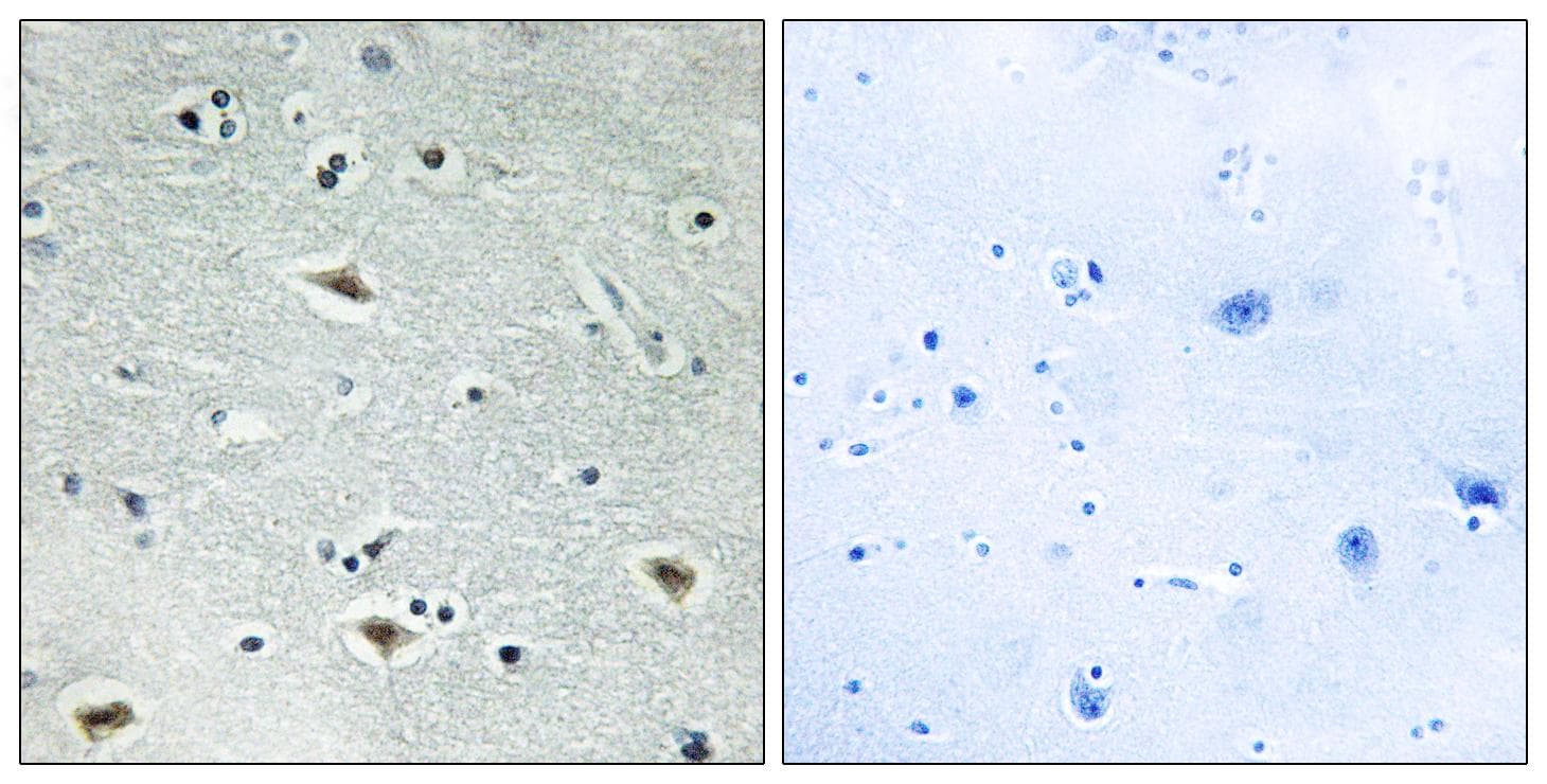 CBFA2T3 Antibody