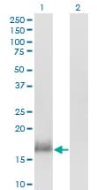 CALML3 Antibody (clone 2A11)