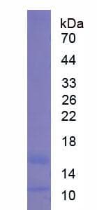 Mouse Calprotectin Protein (Recombinant His,N-terminus)
