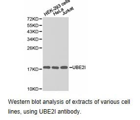 Polyclonal Rabbit anti-Human UBE2I / UBC9 Antibody (IHC, WB)