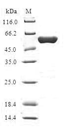 Human HMGN2 Protein (Recombinant GST, N-terminus)
