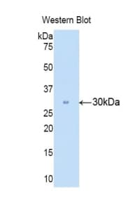 CA2 / Carbonic Anhydrase II Antibody (aa5-258)