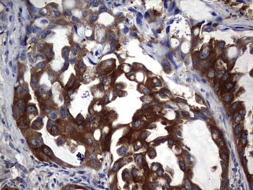 PKM2 Antibody (clone 1A1)