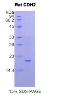 Rat CDH2 / N Cadherin Protein (Recombinant His)