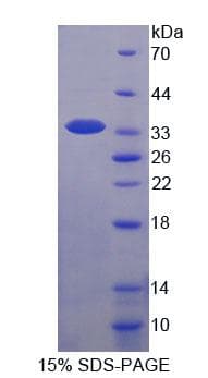 Human WWP2 Protein (Recombinant His-T7, N-terminus)
