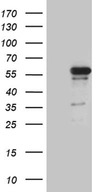 Monoclonal Mouse anti-Human RUNX3 Antibody (clone OTI11D5, Carrier-free, IHC, WB)